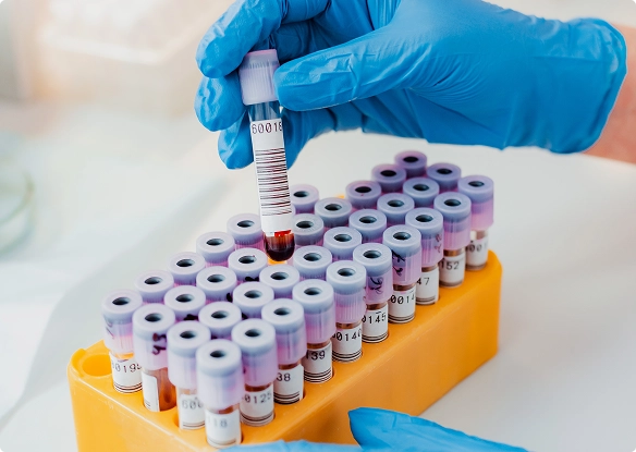 A person wearing blue gloves holds a tube of blood, preparing for a medical procedure or analysis A person wearing blue gloves holds a tube of blood, preparing for a medical procedure or analysis